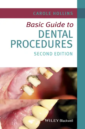 Hollins |  Basic Guide to Dental Procedures | Buch |  Sack Fachmedien