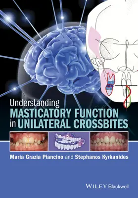 Piancino / Kyrkanides |  Understanding Masticatory Function in Unilateral Crossbites | Buch |  Sack Fachmedien