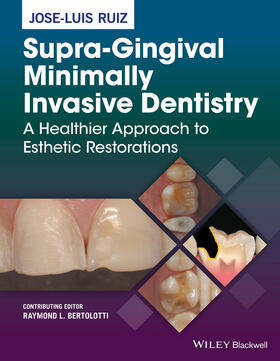 Ruiz |  Supra-Gingival Minimally Invasive Dentistry | Buch |  Sack Fachmedien
