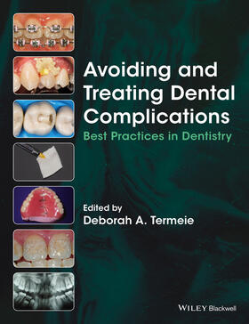 Termeie |  Avoiding and Treating Dental Complications | Buch |  Sack Fachmedien