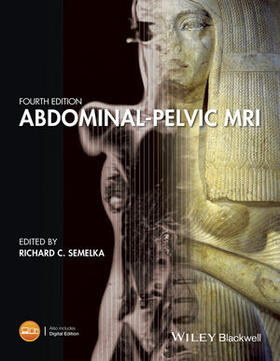 Semelka / Brown / Altun |  Abdominal-Pelvic MRI | Buch |  Sack Fachmedien
