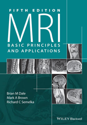 Dale / Brown / Semelka |  MRI | Buch |  Sack Fachmedien