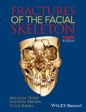 Perry / Brown / Banks |  Fractures of the Facial Skeleton | eBook | Sack Fachmedien