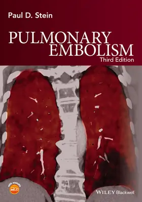 Stein |  Pulmonary Embolism | Buch |  Sack Fachmedien