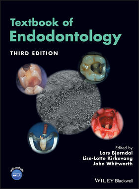 Bjørndal / Kirkevang / Whitworth |  Textbook of Endodontology | Buch |  Sack Fachmedien