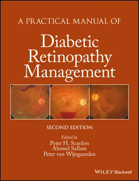 Scanlon / Sallam / van Wijngaarden |  A Practical Manual of Diabetic Retinopathy Management | Buch |  Sack Fachmedien