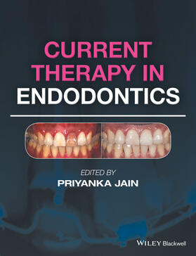 Jain |  Current Therapy in Endodontics | Buch |  Sack Fachmedien
