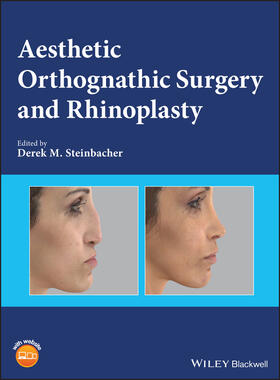 Steinbacher |  Aesthetic Orthognathic Surgery and Rhinoplasty | Buch |  Sack Fachmedien