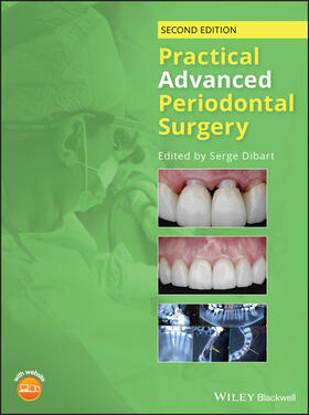 Dibart |  Practical Advanced Periodontal Surgery | Buch |  Sack Fachmedien