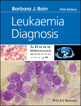 Bain |  Leukaemia Diagnosis | Buch |  Sack Fachmedien