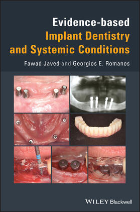 Javed / Romanos |  Evidence-Based Implant Dentistry and Systemic Conditions | Buch |  Sack Fachmedien