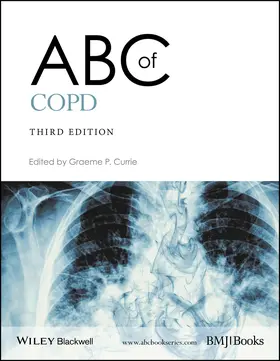 Currie |  ABC of Copd | Buch |  Sack Fachmedien