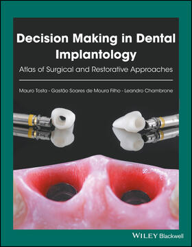 Tosta / de Moura Filho / Chambrone |  Decision Making in Dental Implantology | Buch |  Sack Fachmedien