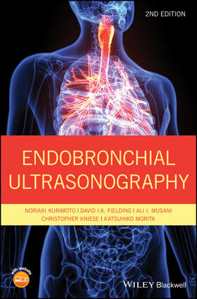 Kurimoto / Fielding / Musani |  Endobronchial Ultrasonography | Buch |  Sack Fachmedien