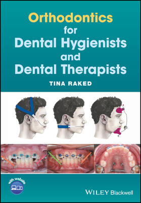 Raked |  Orthodontics for Dental Hygienists and Dental Therapists | Buch |  Sack Fachmedien