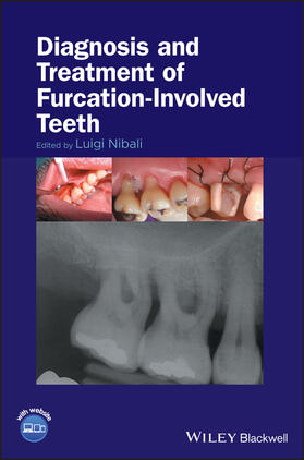 Nibali |  Diagnosis and Treatment of Furcation-Involved Teeth | Buch |  Sack Fachmedien