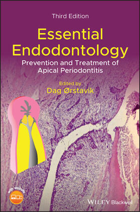 Orstavik |  Essential Endodontology | Buch |  Sack Fachmedien