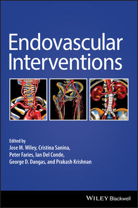 Wiley / Sanina / Faries |  Endovascular Interventions | Buch |  Sack Fachmedien