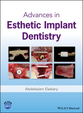 Elaskary |  Advances in Esthetic Implant Dentistry | Buch |  Sack Fachmedien