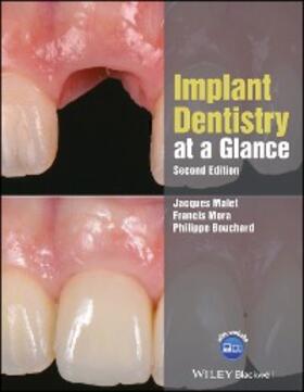 Malet / Mora / Bouchard |  Implant Dentistry at a Glance | eBook | Sack Fachmedien