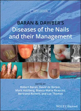 Baran / de Berker / Holzberg |  Baran and Dawber's Diseases of the Nails and Their Management | Buch |  Sack Fachmedien