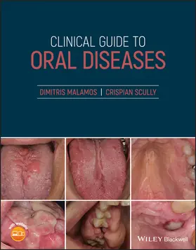 Scully / Malamos |  Clinical Guide to Oral Diseases | Buch |  Sack Fachmedien