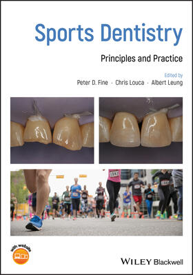 Fine / Louca / Leung |  Sports Dentistry | Buch |  Sack Fachmedien