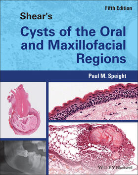 Speight |  Shear's Cysts of the Oral and Maxillofacial Regions | Buch |  Sack Fachmedien