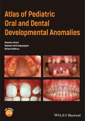 Ansari / Golpayegani / Welbury |  Atlas of Pediatric Oral and Dental Developmental Anomalies | Buch |  Sack Fachmedien