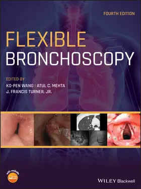 Wang / Mehta / Turner |  Flexible Bronchoscopy | Buch |  Sack Fachmedien