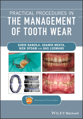 Banerji / Mehta / Opdam |  Practical Procedures in the Management of Tooth Wear | Buch |  Sack Fachmedien