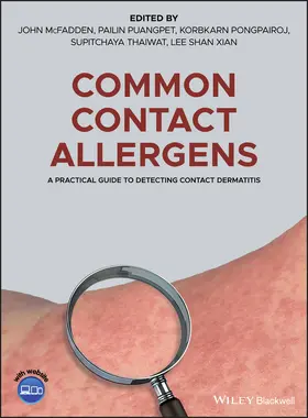 McFadden / Puangpet / Pongpairoj |  Common Contact Allergens | Buch |  Sack Fachmedien