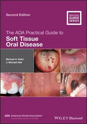 Kahn / Hall |  The ADA Practical Guide to Soft Tissue Oral Disease | Buch |  Sack Fachmedien