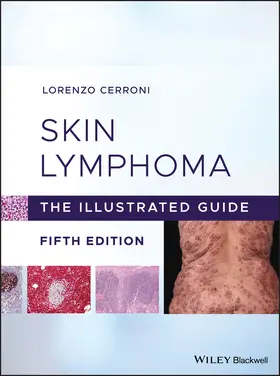 Cerroni |  Skin Lymphoma | Buch |  Sack Fachmedien