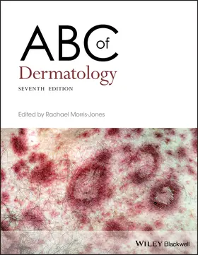 Morris-Jones |  ABC of Dermatology | Buch |  Sack Fachmedien