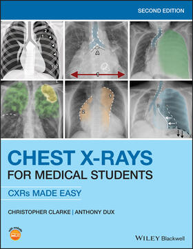 Clarke / Dux |  Chest X-Rays for Medical Students | Buch |  Sack Fachmedien