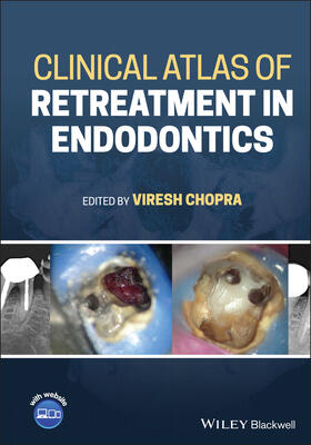 Chopra |  Clinical Atlas of Retreatment in Endodontics | Buch |  Sack Fachmedien
