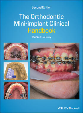 Cousley |  The Orthodontic Mini-Implant Clinical Handbook | Buch |  Sack Fachmedien
