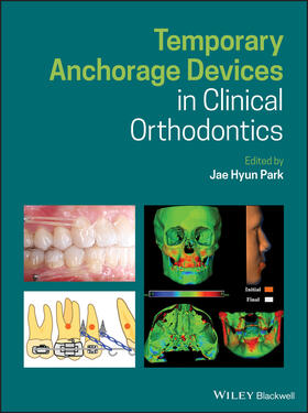 Park |  Temporary Anchorage Devices in Clinical Orthodontics | Buch |  Sack Fachmedien