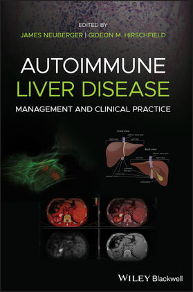 Neuberger / Hirschfield |  Autoimmune Liver Disease | Buch |  Sack Fachmedien