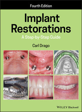 Drago |  Implant Restorations | Buch |  Sack Fachmedien