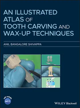 Bangalore Shivappa |  An Illustrated Atlas of Tooth Carving and Wax-Up Techniques | Buch |  Sack Fachmedien