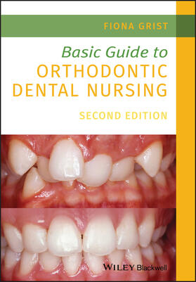 Grist |  Basic Guide to Orthodontic Dental Nursing | Buch |  Sack Fachmedien