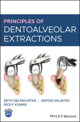 Delpachitra / Sklavos / Kumar |  Principles of Dentoalveolar Extractions | Buch |  Sack Fachmedien
