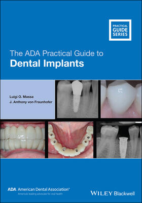 Massa / von Fraunhofer |  The ADA Practical Guide to Dental Implants | Buch |  Sack Fachmedien