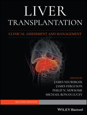 Neuberger / Ferguson / Newsome |  Liver Transplantation | Buch |  Sack Fachmedien