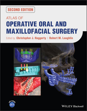 Haggerty / Laughlin |  Atlas of Operative Oral and Maxillofacial Surgery | Buch |  Sack Fachmedien