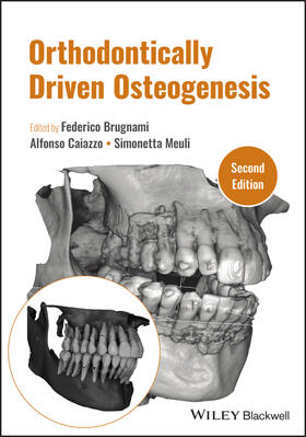 Caiazzo / Brugnami / Meuli |  Orthodontically Driven Osteogenesis | Buch |  Sack Fachmedien