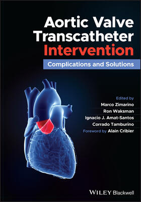 Zimarino / Waksman / Amat-Santos |  Aortic Valve Transcatheter Intervention | Buch |  Sack Fachmedien