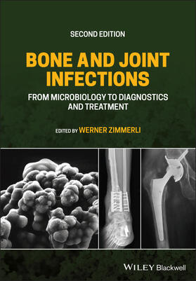 Zimmerli |  Bone and Joint Infections | Buch |  Sack Fachmedien